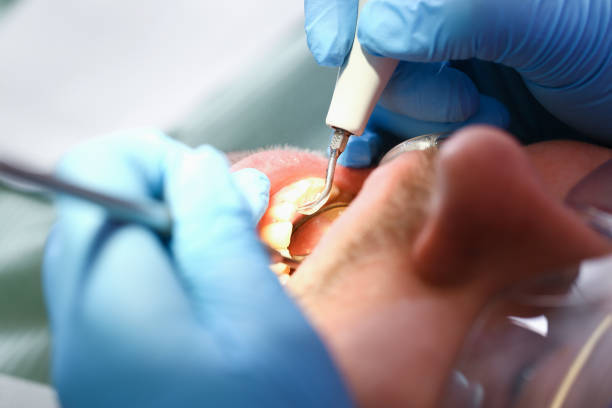 Best Emergency Treatment for Jaw Pain or Injury in Belmont, PA